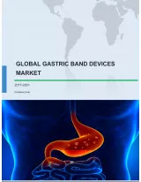 Global Gastric Band Devices Market 2017-2021